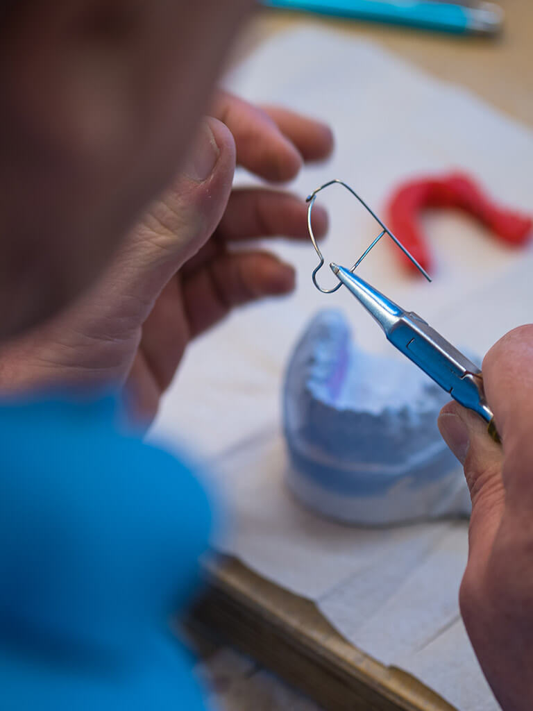 Detailbild einer Zahnspangendrahtbearbeitung der Zahntechnik.